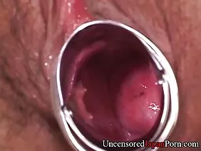 Secretary has raped the head